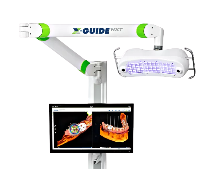 X-Guide